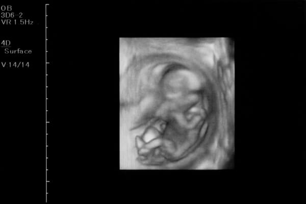 助産師監修 妊娠14週目 妊娠4ヶ月 のお腹の中の赤ちゃんの様子について