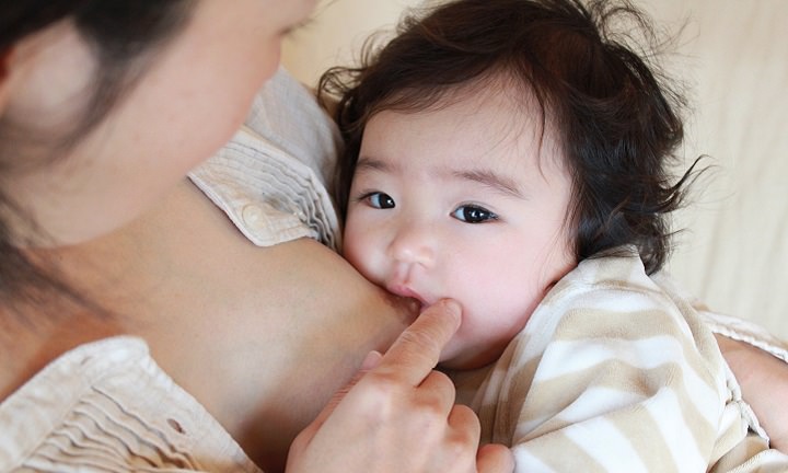 母乳分泌過多症