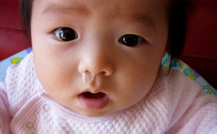 【助産師監修】新生児・赤ちゃんの鼻づまり－原因と解消法－│AMOMA