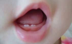 【助産師監修】赤ちゃんに歯が生えたときの授乳