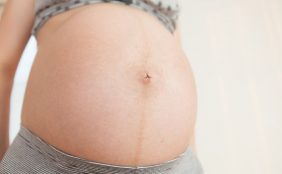 【助産師監修】正中線とは?妊娠中にお腹にできる黒い線。